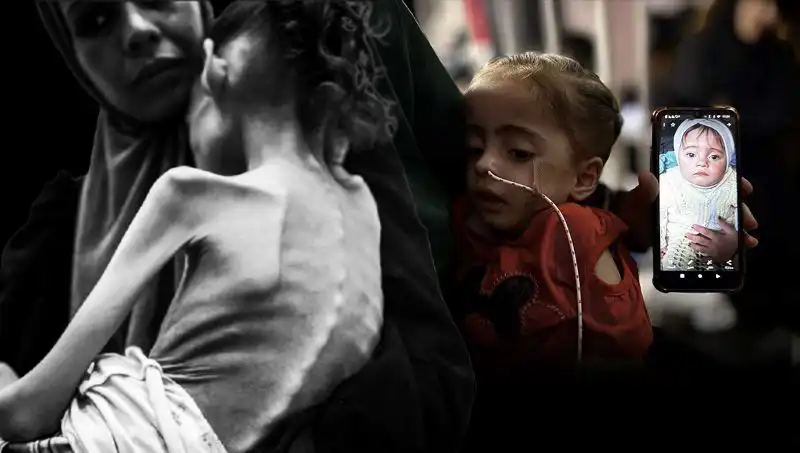 Küçük Meryem Yalnızca 10 Kilo: Açlıkla Amansız Mücadele