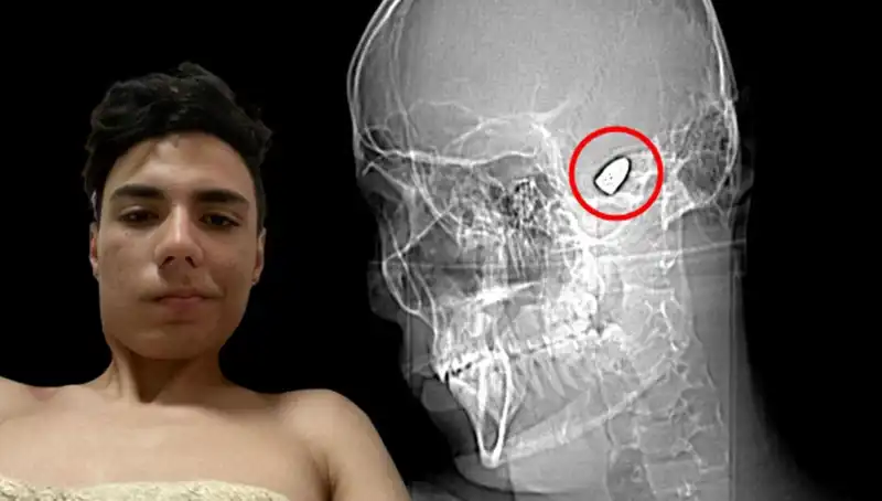 Kafasında Patlayan Düşünceler: Hayatın Korkutan Tarafları