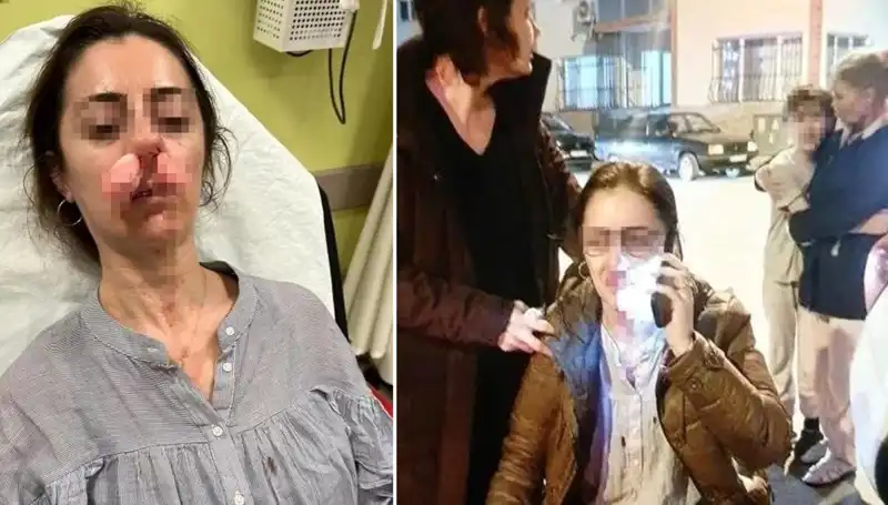 Eşinin Sevgilisi Sandığı Otomobil Kapısıyla Saldırdı! Olayın Detayları Şoke Etti!